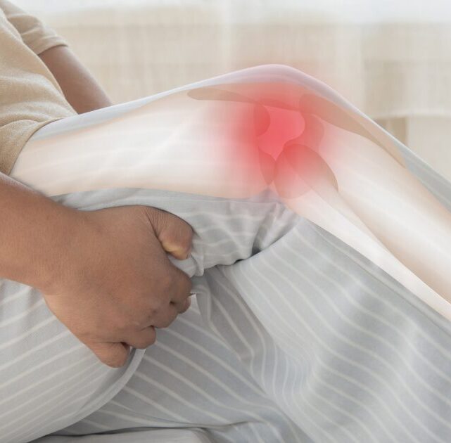 Ilustračné zobrazenie bolesti kolena pri pohybových problémoch, ktoré rieši McKenzie metóda